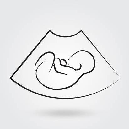 Sonoscan Ultrasound Care